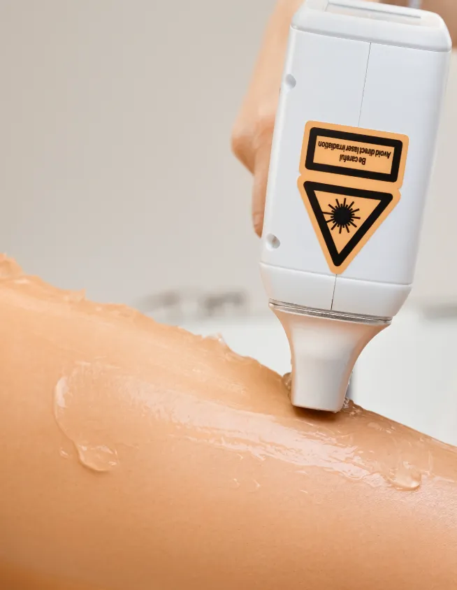 laser pro service 3