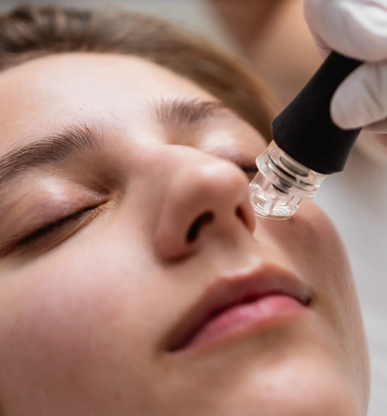 laser pro med spa microneedling about us